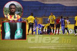 Gerson Chávez le desea pronta recuperación a Erick Andino.