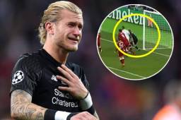 Karius recibió un fuerte golpe de Ramos en la final de Champions que le provocó discapacidad visual.