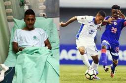 El futbolista de la Selección Sub-17 de Honduras, Cristian Madrid, se pierde la Copa del Mundo de la India 2017 por la rotura de ligamentos. Fotos cortesía