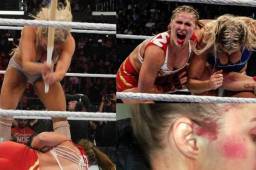 La excampeona de la UFC también ha pedido la revancha y lo hizo compartiendo las fotos más violentas de su combate contra Charlotte Flair en las Survivor Series.