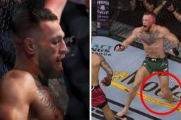 Así fue la impactante lesión de Conor McGregor en su pelea ante Dustin Poirier.