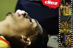 Las imágenes que quizás no viste desde estos ángulos del duelo de vuelta entre Real España y Honduras Progreso por el repechaje.