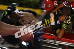 Donis Escober y su lesión encendió las alarmas en el Olimpia. Imágenes fuertes al ser trasladado en ambulancia.