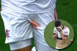 Gustavo Henrique se marchó entre lágrimas tras ver que la sangre seguía brotando de sus partes íntimas.