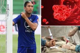 Te contamos detalles de la preleucemia que sufre el volante del Motagua Santiago Vergara, las causas, síntomas y el tratamiento a seguir.