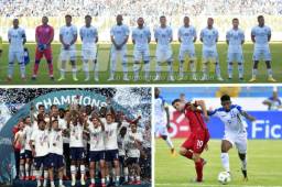 Estados Unidos tiene bajas importantes: ¿Crees que Honduras conquiste su primer triunfo en esta eliminatoria ante las barras y las estrellas el miércoles?