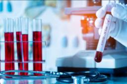 Casi 13.000 personas han muerto por el virus en Lombardía, cuya capital es Milán, es decir más de la mitad de los 25.000 fallecidos en la península.