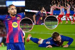 EN FOTOS: Jugador del Barcelona no celebró el gol ante el Atlético, la lesión horrorosa de Dani Olmo y las polémicas que recorre el mundo que 'favorecieron' al equipo de Hansi Flick.