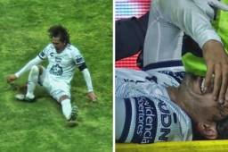 Así fue la terrible lesión del jugador de Pachuca.
