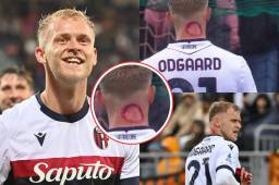 En redes sociales dispararon las más alocadas teorías por la marca en el cuello que exhibió durante la victoria del Bologna ante el Venezia