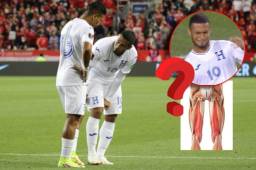 Alex López no se descarta para la triple fecha eliminatoria en octubre. El doctor del Alajuelense explica su lesión exacta y la gran evolución que esta ha tenido, al igual que un tiempo estimado de recuperación.