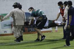 Aldair Simanca Peña, defensa de Platense, tuvo que ser trasladado de inmediato a un hospital y hoy será evaluado para determinar si recibe o no el alta.