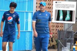 Diego Vázquez puso en duda que la cuenta de Twitter en la que respondieron a Hernán Medford sea suya. Foto Ronald Aceituno