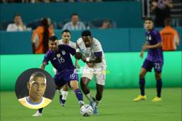 Carlo Costly sobre el amistoso ante Argentina: “Es difícil calificar a una selección de Honduras que no jugó a nada”