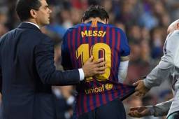 Messi salió adolorido por sufrir una fractura del radio del brazo derecho en su partido contra el Sevilla.