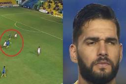 Mario Ricardo la historia detrás de un jugador que en su niñez perdió un ojo debido a un accidente automovilístico.