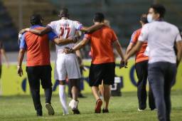 El delantero hondureño Jerry Bengtson cuando salía lesionado del campo luego de la entrada que le hizo el portero del Real España, Luis 'Buba' López. Fotos | DIEZ