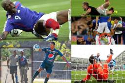 Estas son algunas de las peores lesiones que se han dado en el fútbol. André Gomes fue el último en sufrir una en el juego Everton - Tottenham de la Premier League.