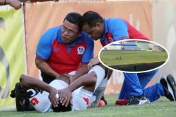 Raúl Pérez explicó que una de las razones en la lesión de Ever Alvarado ha sido el estado de la cancha del estadio Nacional.