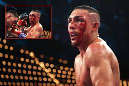 Teófimo López peleó ante George Kambosos con neumomediastino severa, según deslevaron los reportes médicos de su salud.