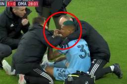 El mediocampista hondureño Kervin Arriaga salió tocado y podría ser baja en Honduras.