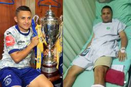 Omar Elvir festejó a medias la Copa 15 del Motagua, el jugador viajó este lunes a San Pedro Sula para someterse a una operación.