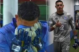 Las lágrimas del portero del Olimpia, Harold Fonseca, cuando quedaron eliminados de la final de la Liga Concacaf donde falló en el lanzamiento penal ante Alajuela.