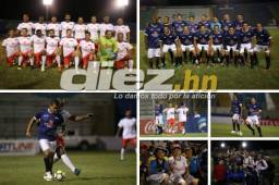 El partido se ha organizado con el fin de recaudar fondos para la Fundación Hondureña de Niños Quemados. Olimpia se llevó la victoria con marcador de 2-1. FOTOS: Johny Magallanes.