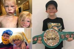 Bridger Walker es un niño de 6 años que estaba dispuesto a dar su vida por salvar a su hermana del voraz ataque de un perro. El pequeño se ganó el corazón de muchos y ahora fue reconocido por el CMB.