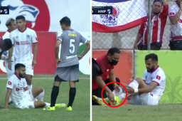 Malas noticias en Olimpia: Jorge Álvarez se lesiona el tobillo y salió de cambio apenas al minuto 30