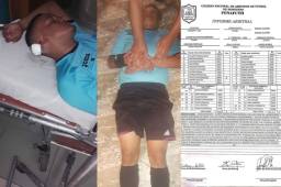 El árbitro Héctor Medrano al momento cuando era atendido tras recibir el botellazo en la cabeza por parte de un aficionado del Real Juventud en Quimistán.