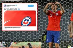 Enzo Roco será baja de Chile para enfrentar a Honduras en Temuco.