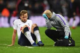 El pasado domingo Kane sufrió una entrada del rival Phil Jones en los últimos segundos del partido y abandonó el césped cojeando.