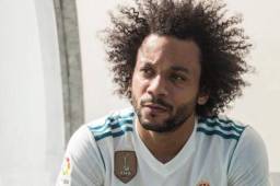 Marcelo, jugador del Real Madrid, actualmente está lesionado.