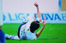 La escalofriante lesión de Alejandro Arribas en el clásico capitalino ante el América.