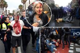 91 heridos es el saldo que dejaron los incidentes ocurridos este domingo durante la celebración del referéndum de independencia en Cataluña, que la policía trata de impedir.