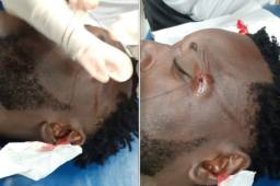 Wilmer Crisanto recibió varias puntadas luego del encuentro.