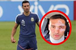 Tras ser atendido en la clínica, el seleccionador argentino ha sido dado de alta.