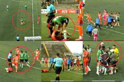 Se soltaron puñetazos: así fue la pelea entre jugadores de Lobos y Juticalpa que le terminó costando la roja a David Mendoza