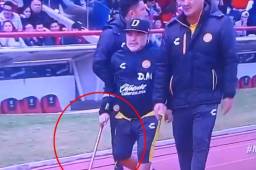 Diego Maradona sufre una severa artrosis en sus dos rodillas, según su doctor.