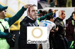 CONCACAF anuncia que iniciará una investigación para esclarecer los hechos, encontrar a los culpables y aplicar las sanciones pertinentes.