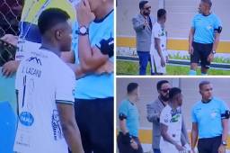 Insólito momento: Júnior Lacayo tuvo que abandonar el partido Juticalpa vs Platense en el Óscar Peralta tras vivir incómoda situación