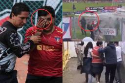 ¡Lamentable! La Policía disparó en pleno festejo de gol e hincha perdió su ojo: Se quería mantener el control de la visita