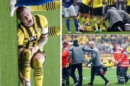Durísimo: entre lágrimas, Marco Reus salió lesionado con el Dortmund y peligra a perderse otro Mundial con Alemania