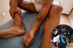 Santi Cazorla vive una pesadilla por no poder jugar fútbol y estar al borde del retiro apenas a sus 32 años-