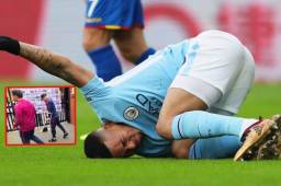 Gabriel Jesús tuvo que salir con muletas producto de su nueva lesión.