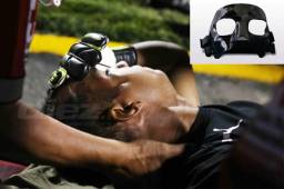 Donis Escober fue operado en una clínica de Tegucigalpa y en tres semanas regresará a las canchas, pero deberá utilizar una máscara de protección mientras se recupera del todo. Foto DIEZ