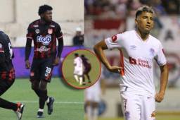 Edson Palacios revela lo que José Mario Pinto le dijo y que provocó los golpes: “Eso me calentó”