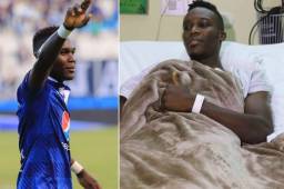 Rubilio Castillo ha venido arrastrando una lesión en su rodilla que se ha complicado y en el PAS Giannina detectaron este problema.