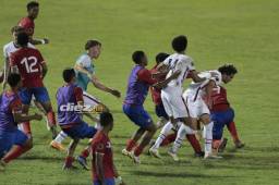 Costa Rica, el más afectado tras los incidentes ocurridos en el partido ante Estados Unidos. Foto: Neptalí Romero.